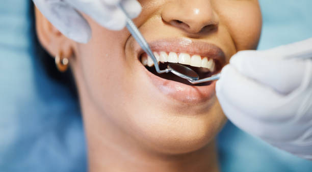 Best Emergency Broken Tooth Repair in Hernando, MS