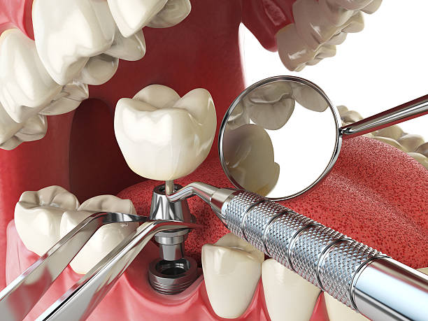 Best Emergency Broken Tooth Repair in Hernando, MS